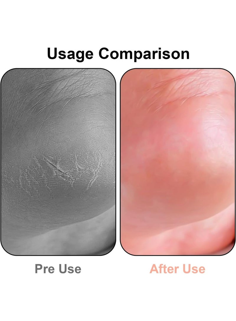 مبرد نانو زجاجي للقدمين، مزيل للجلد الميت، ذو ملمس ناعم ولطيف على البشرة، لإزالة الجلد الميت والجلد الميت. - Image 5